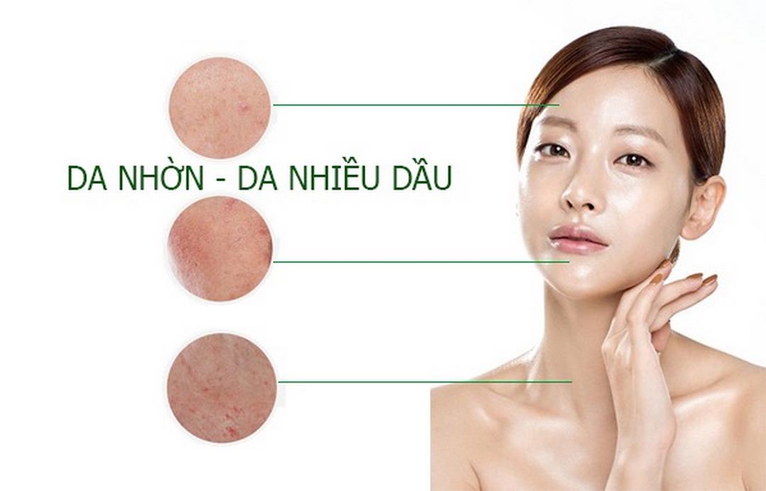 Làn da nhờn, da dầu mụn cần chú ý khi chăm sóc