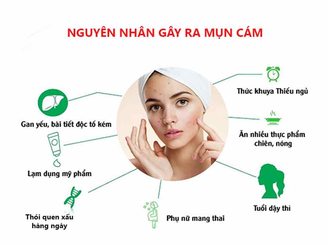 Biết được nguyên nhân sẽ biết được cách trị mụn cám hiệu quả