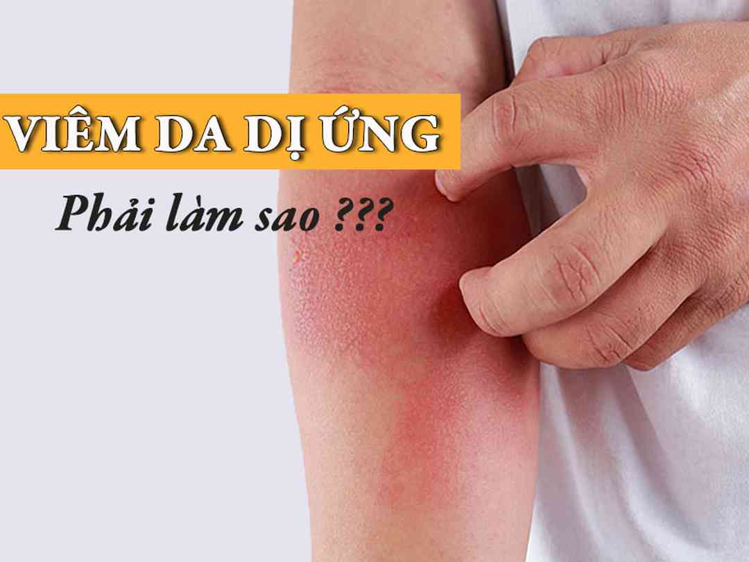  Lối sống lành mạnh và làn da trắng khỏe tuyệt vời 