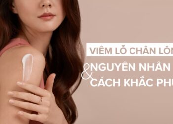 Nguyên nhân viêm nang lông do đâu?