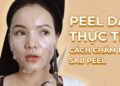 Lưu ý khi peel da về các tác dụng phụ