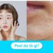 Quy trình peel da làm đẹp
