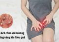 Sử dụng thuốc chữa viêm lỗ chân lông vùng kín
