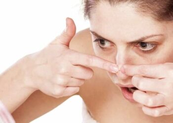 Những quy tắc về chăm sóc da sau nặn mụn 