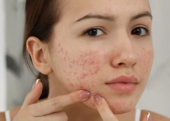 Gây ra các tác động mạnh