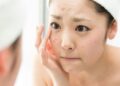Làm thế nào để sử dụng lô hội trị mụn?