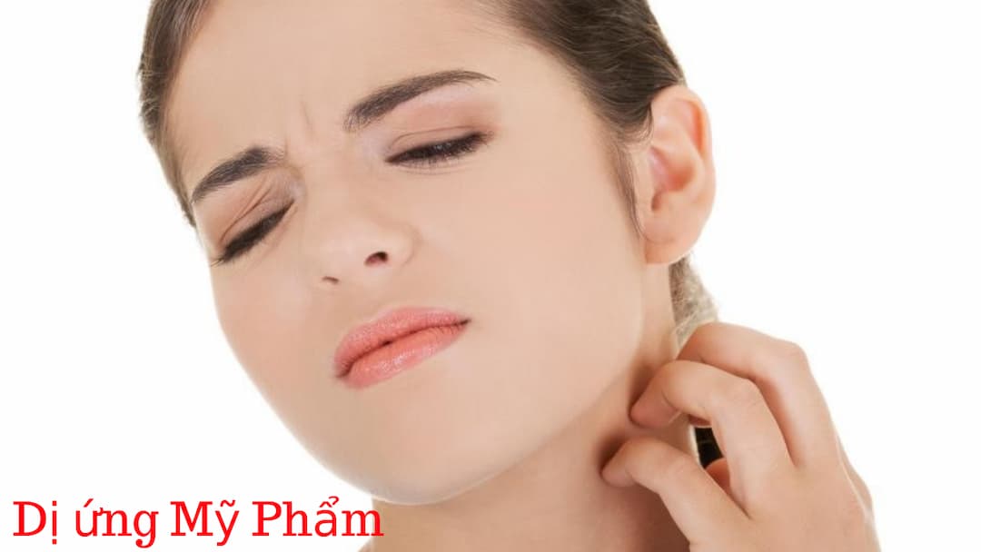 Nguyên nhân gây ra dị ứng mỹ phẩm