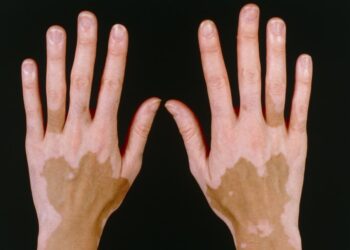 Tác động của môi trường và thói quen sinh hoạt