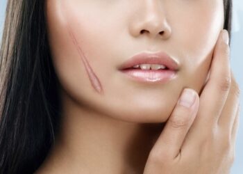 Lưu ý khi dùng kem trị sẹo