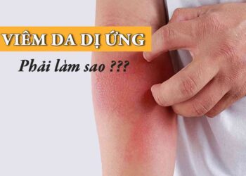  Lối sống lành mạnh và làn da trắng khỏe tuyệt vời 