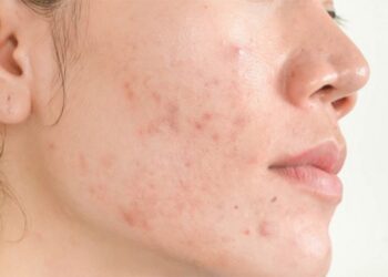 Những tình trạng xấu do dị ứng trên da