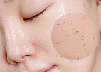 Lý do cần phải tẩy da chết là gì bạn đã biết chưa?