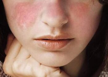 Cách Chọn Mỹ Phẩm Phù Hợp Với Loại Da Của Bạn