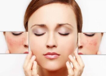 Cách nhận biết dị ứng mỹ phẩm bằng cách quan sát da