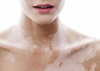 Bí quyết của chuyên gia