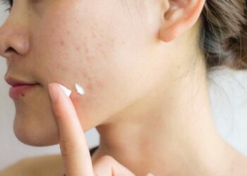 Các yếu tố cần xét khi lựa chọn kem trị sẹo